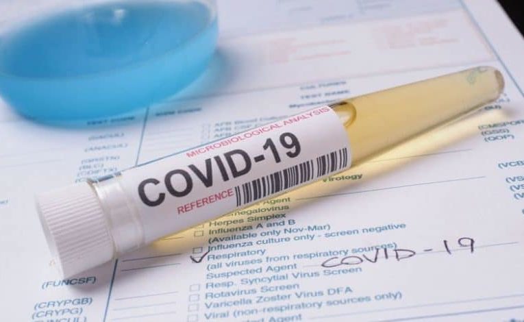 فيروس كورونا يظهر بـ 30 طفرة جينية “عدوانية” جديدة